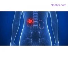 Kidney Stone Treatment in Delhi