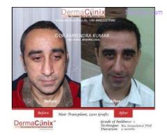 Largest Hair Transplantation Center in Asia
