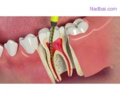 Opt for Bleeding Gum Treatment without Delay to Retain Your Health