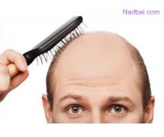 Best Baldness Treatment in Delhi NCR